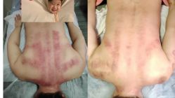 -丽减美瘦吧·减肥瘦身