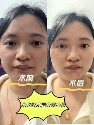 -伊丽莎白医疗美容