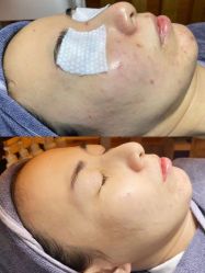 -苗方清颜痘肌研究所