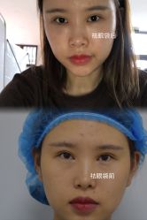 -天津健丽·去眼袋医疗美容机构