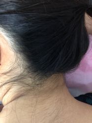 -薇兰专业脱毛连锁机构