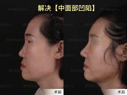 -北京米扬丽格医疗美容·联合丽格鼻整形中心