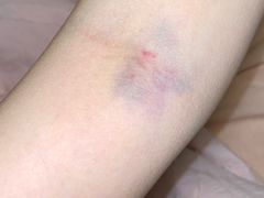 -浙江省中医院(湖滨院区)