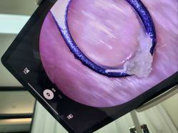 -凡碧诗毛孔清洁收细