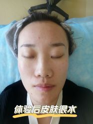 体验后-北京爱育华医院-医疗美容科