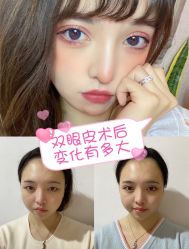 -深圳阳光医疗美容医院·旗舰店