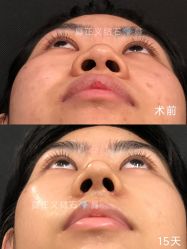 -北京米扬丽格医疗美容·联合丽格鼻整形中心