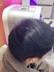 -雍禾植发