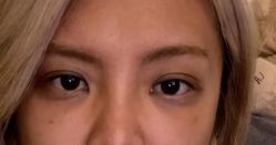 -海涛医疗美容·面部抗衰·注射美鼻