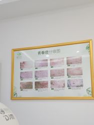 -苗医生0感科技祛痘