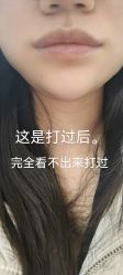 体验前-上海漾颜医疗美容