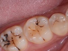 -新达口腔(华东理工大学店)