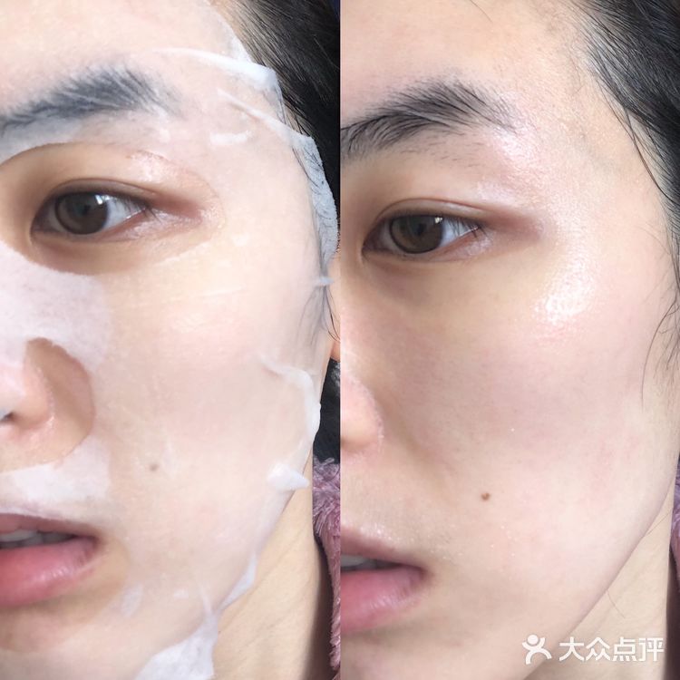 烂脸痘肌救星！平价超好用面膜再回购八百年！