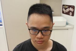-大麦微针植发丨全国连锁