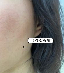 体验后-上海玫瑰医疗美容医院