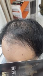 -发饰美男士增发补发假发定制店