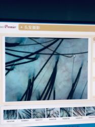 -菩叶脱发白发中心