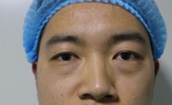 -天津健丽·去眼袋医疗美容机构