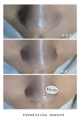 脸部抗衰-光SPA科技美肤