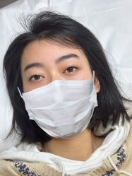 点击看大图 -杨益美学·野生眉半永久纹眉发际线
