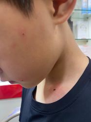 -北京美痣堂古方祛痣斑疣瘊