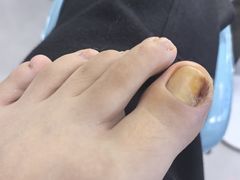 -世龙世家甲沟炎·灰指甲·嵌甲矫正·修脚(武侯区双楠店)