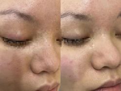 -Cream88颜皮肤管理中心