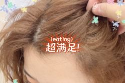 -大麦微针植发全国连锁