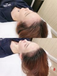 -西施无菌半永久纹绣眉眼影唇轻增发纹发际线
