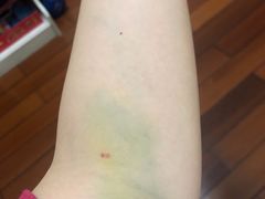 -广州仁爱天河医院体检中心