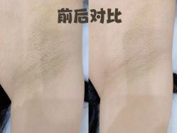 -植蔻妍倍儿专业脱毛·皮肤管理