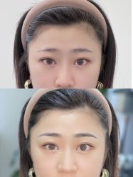 点击看大图 -张小野·专业半永久纹眉