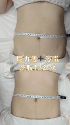 -Lily纤美·科技减脂中心