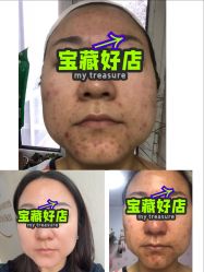 -佳慕·痘痘·问题肌管理中心