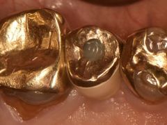 -精德口腔·种植修复·儿牙中心(财富中心店)