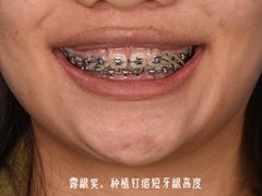 -团圆口腔·种植中心(锦江院区)