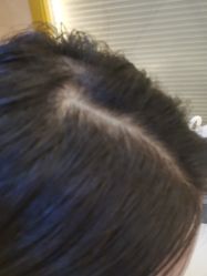 -熙朵美学植发·连锁品牌