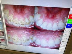 -牙易美口腔(圣堂店)