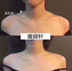 -上海漾颜医疗美容