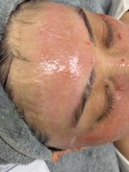 -长沙雅美医疗美容医院