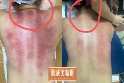-丽减美瘦吧·减肥瘦身