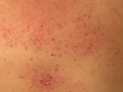 -左悦·艾灸调理·推拿按摩·精油SPA(卓悦汇店)