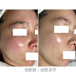 -美肤盾祛痘·问题肌头疗管理中心