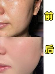-Yestar重庆艺星医疗美容医院