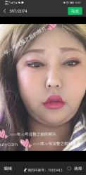 -苗塑堂减肥艾灸