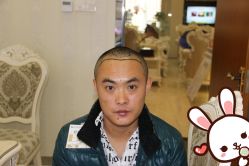 点击看大图 -大麦微针植发丨全国连锁