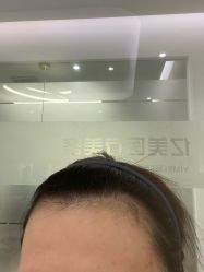 -亿美医疗美容·半岛大超炮官方授权店