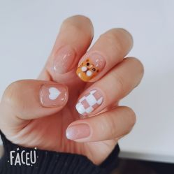 -U-Nail