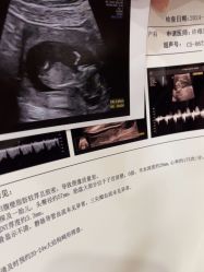 -上海百佳妇产医院