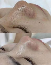 -SKIN79皮肤管理中心